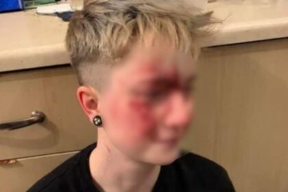 girl attack 1090 scaled