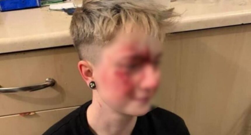 girl attack 1090 scaled