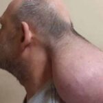 nigritaskefali 750x430 1 scaled