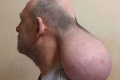 nigritaskefali 750x430 1 scaled