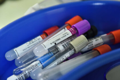 koronoios 32 2048x1407 1