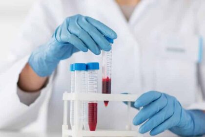 190604140754 blood test