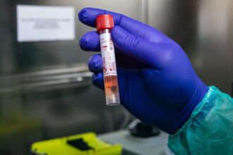 coronavirus 10