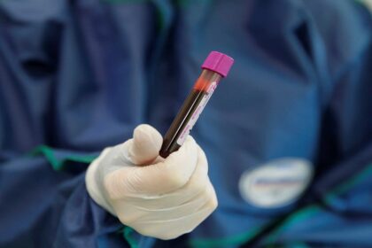 koronoios test 1 2048x1365 1