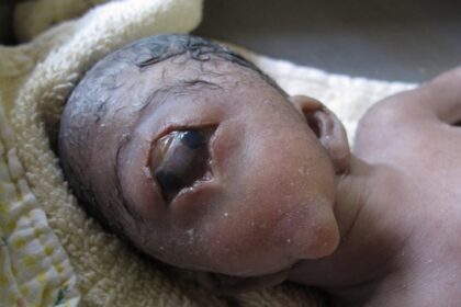 genetikes metallakseis