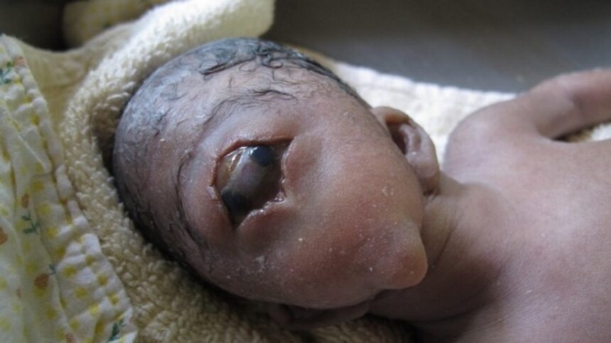 genetikes metallakseis