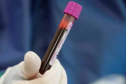 korona germania deigma