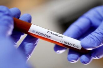 Coronavirus Lab Results REUTERS TT