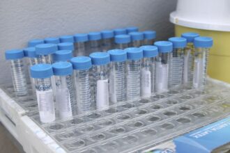 TEST KORONOIOU i