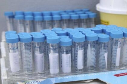 CORONA TEST 1 scaled 1