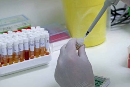 covid test arthro copy 1200x675