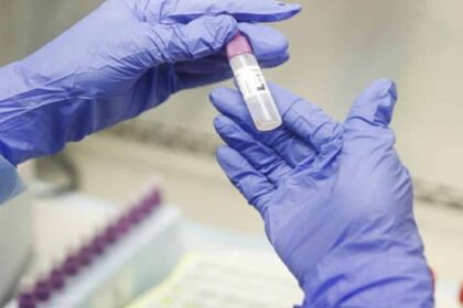 erevna koronoios ergastirio ap