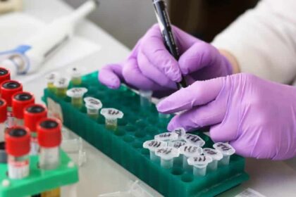 laboratory blood