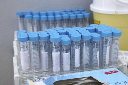 CORONA TEST 2048x1395 1