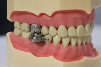 dentalslim device 750x450 1