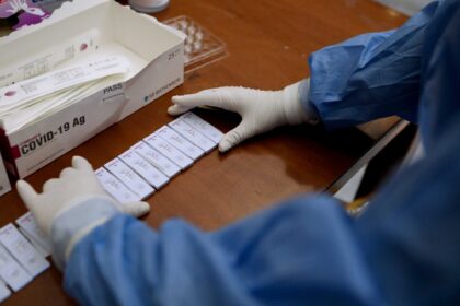 rapid test in 1910 2 2048x1393 1