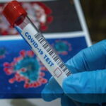 κοβιντ τεστ