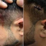 μεταναστης