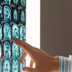 εγκεφφφφφφφφφφφ