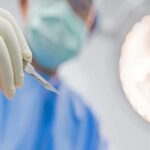 λιποαναρόφηση