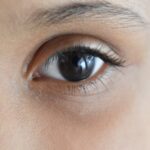 ματια συμπλήρωμα