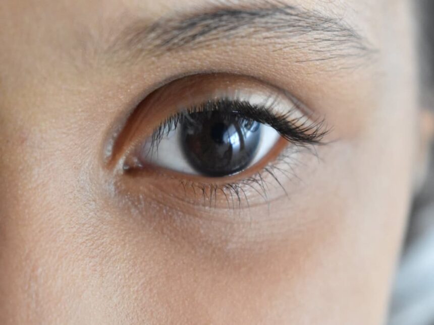 ματια συμπλήρωμα