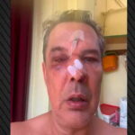 Άνδρας μέσα σε ιδιωτικό ιατρείο στο Χαϊδάρι μετά από επεισόδιο επίθεσης